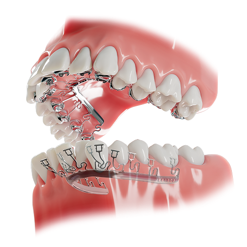 Class-I-Perspective-001-6in 3