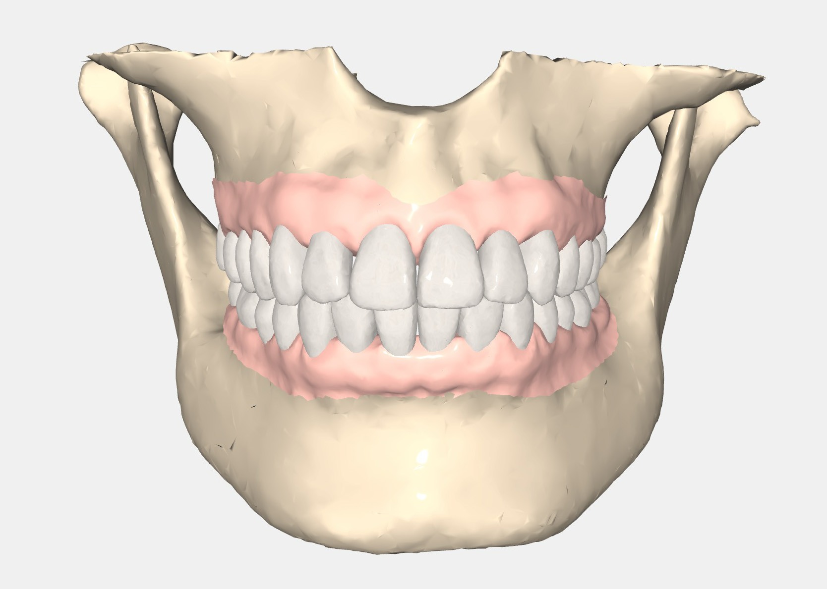 blog - embed cbct 2