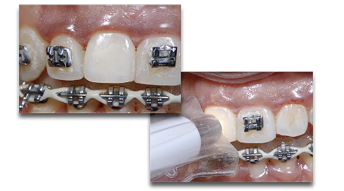 blog-embed-white-spots 1