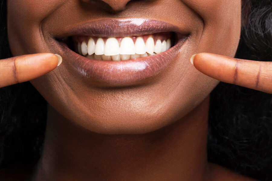 Bright smile showing how to whiten teeth with braces