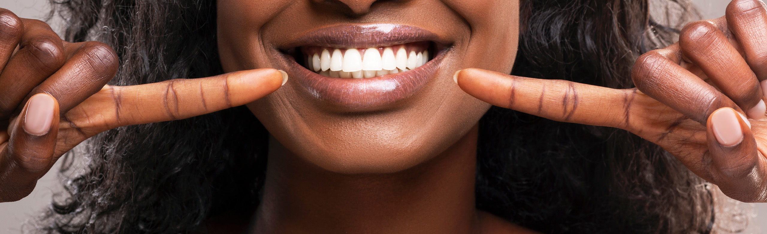 Can You Whiten Your Teeth During Orthodontic Treatment?